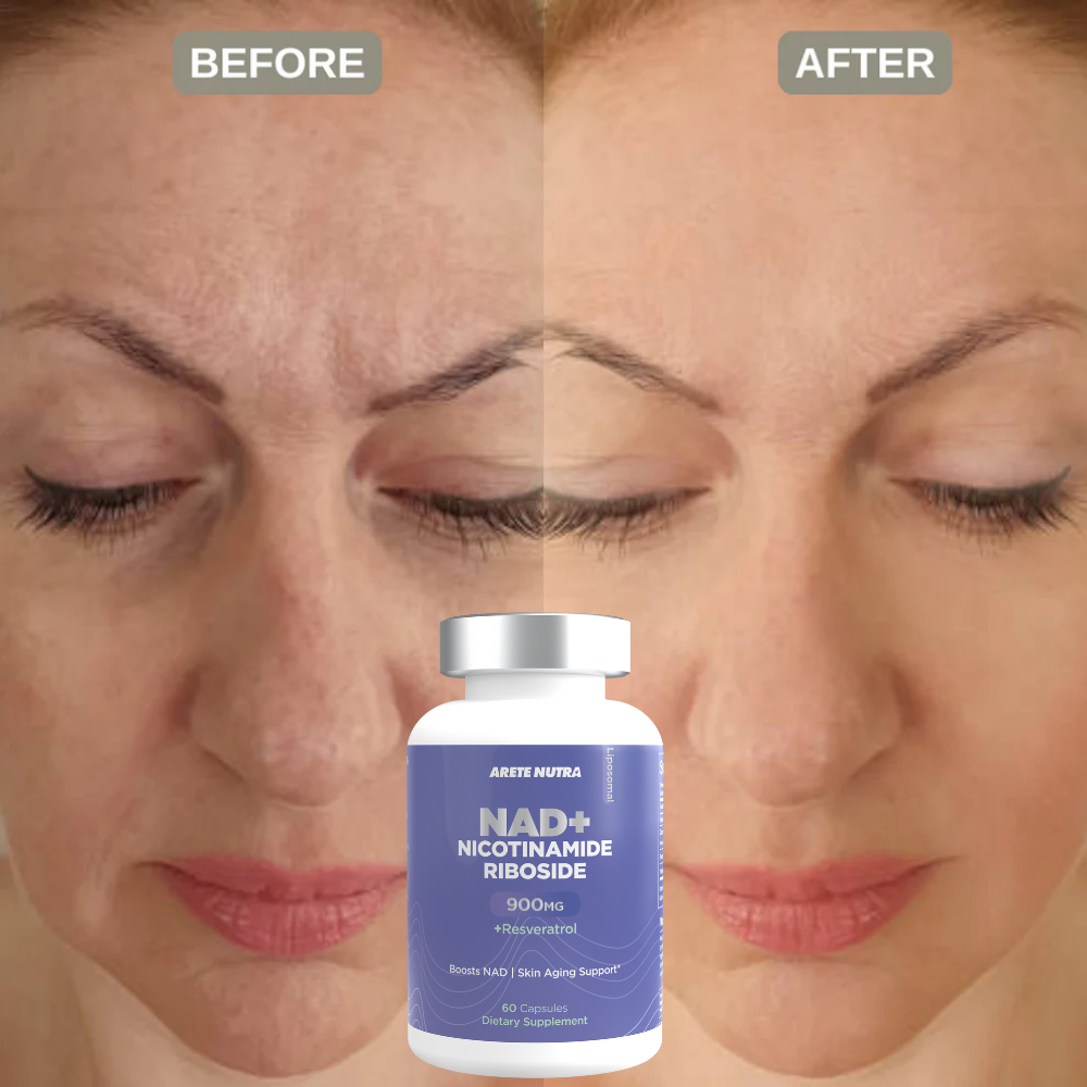 Arete NAD+ Nicotinamide Riboside Plus