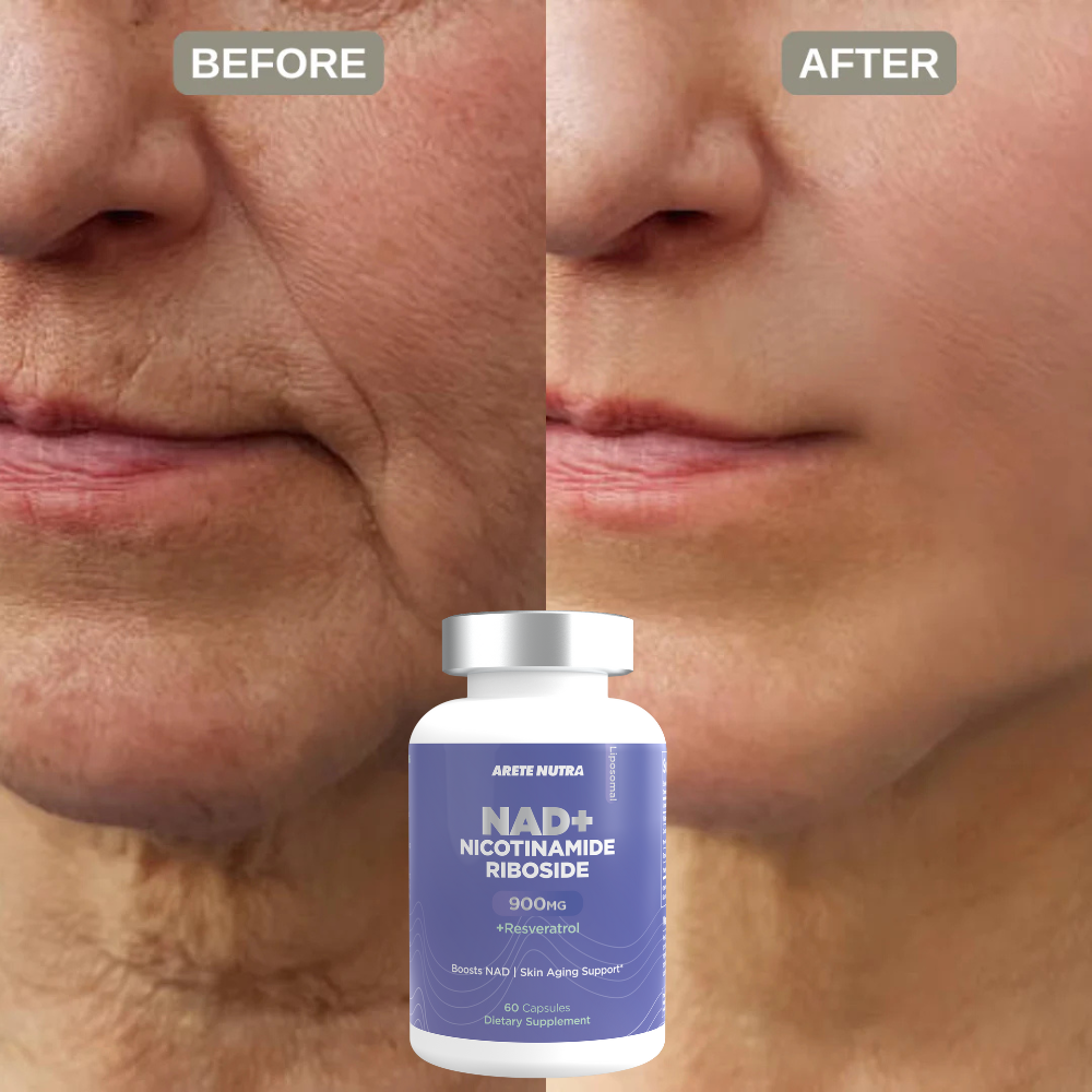 Arete NAD+ Nicotinamide Riboside Plus