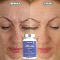 Arete NAD+ - Cellular Energy & Vitality